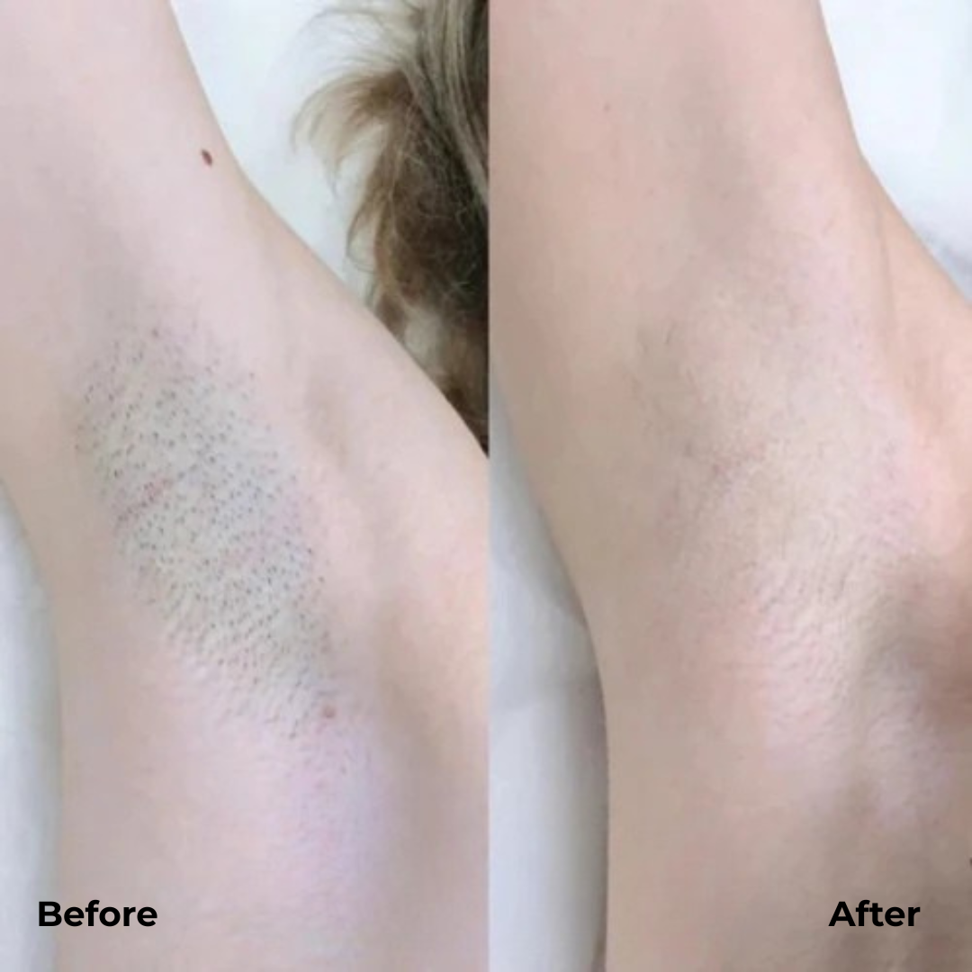 BowLift | DualTrim Precision Shave Comfort