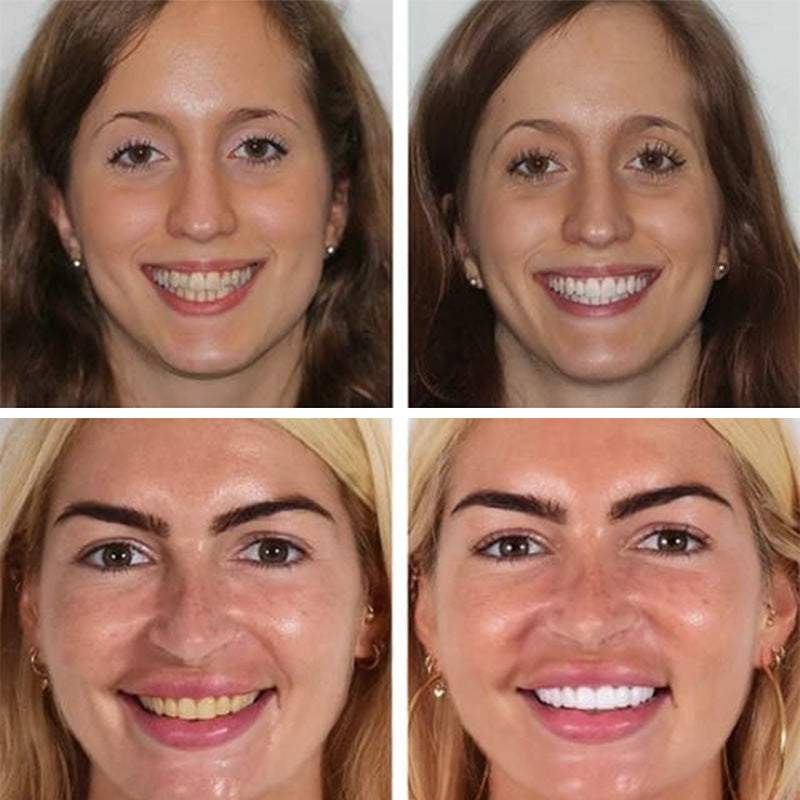 BowLift | Super Probiotic-6 Toothpaste