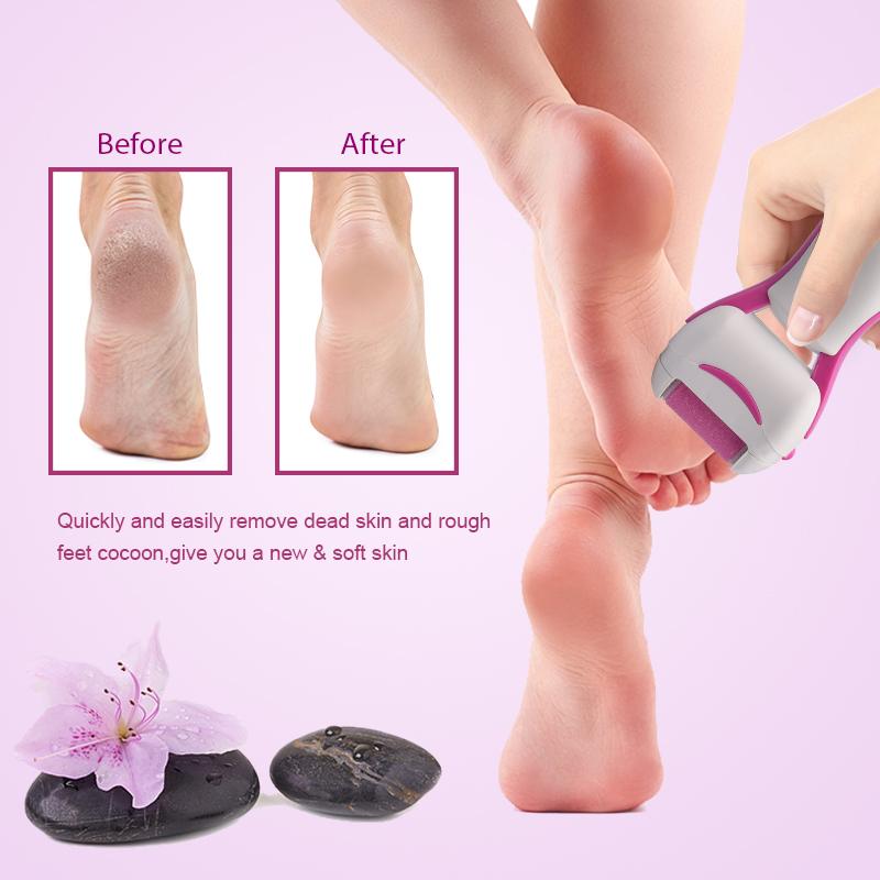 BowLift | Electric Pedicure Tool