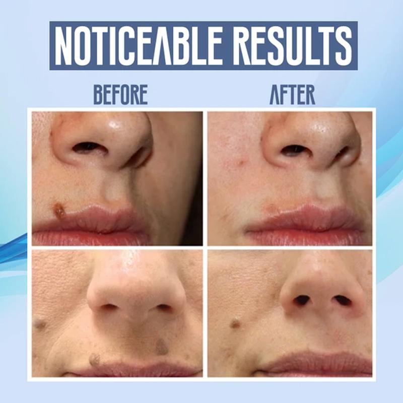 BowLift | Facial Hair Removal Pen