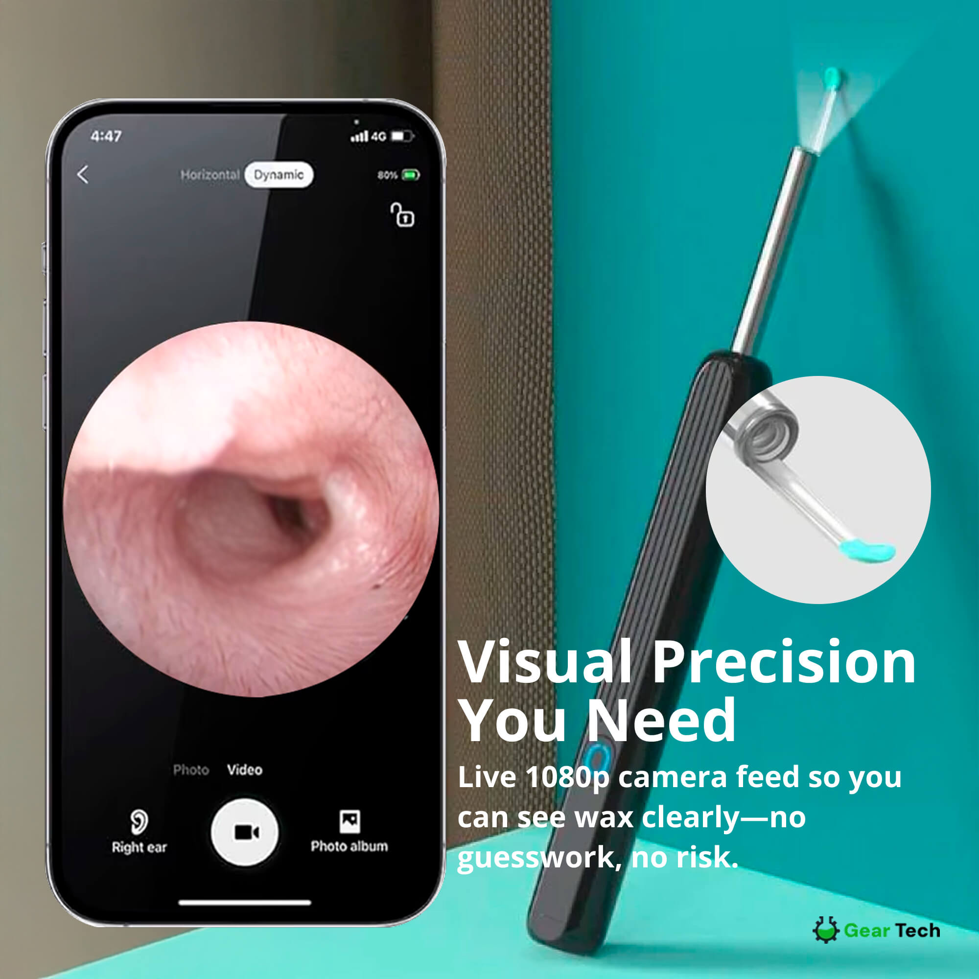 BowLift | EarScope Pro Ear Wax Removal Kit | High-Resolution Camera & LED Lights for Safe Home Use