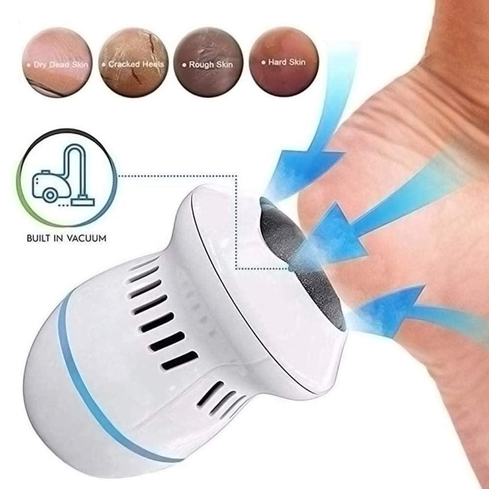 BowLift | GlattFuß™ Foot Care - Electric Callus Remover