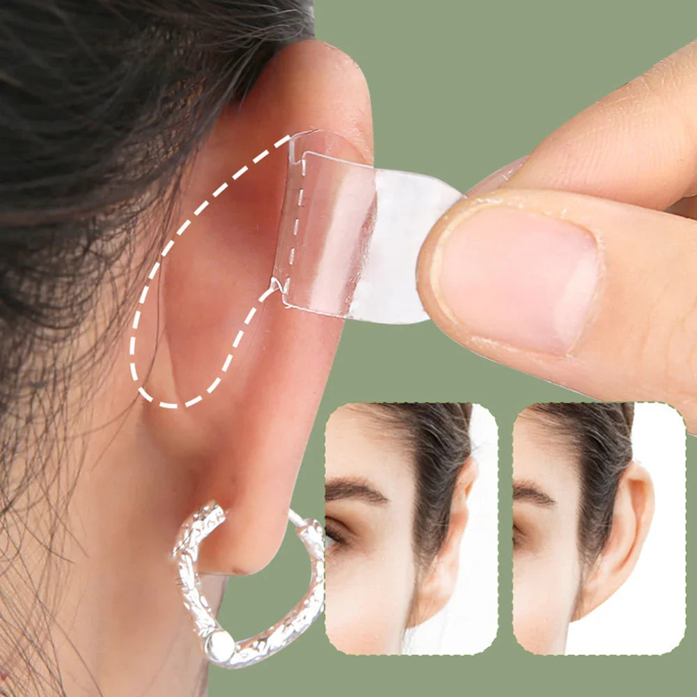 BowLift | Invisible Ear Corrector Stickers