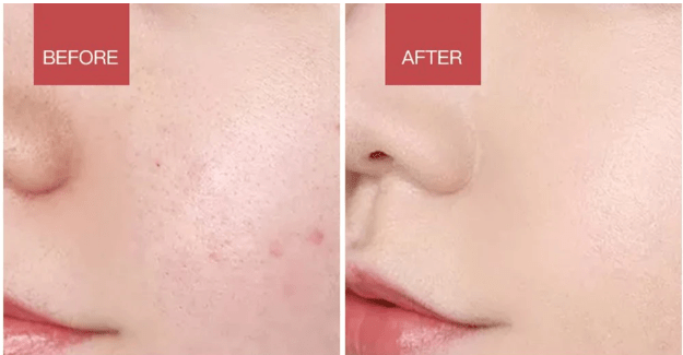 BowLift | Electric facial cleanser with LED light & 42 °C heat technology | Silicone skincare device with sound vibration