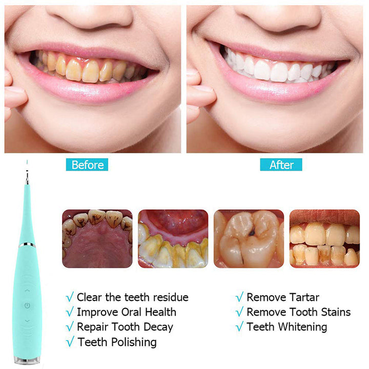 BowLift | Teeth Flosser