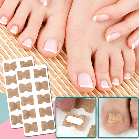 BowLift | ProFlexiPatches — Pain-free natural nails that you show off again with pride