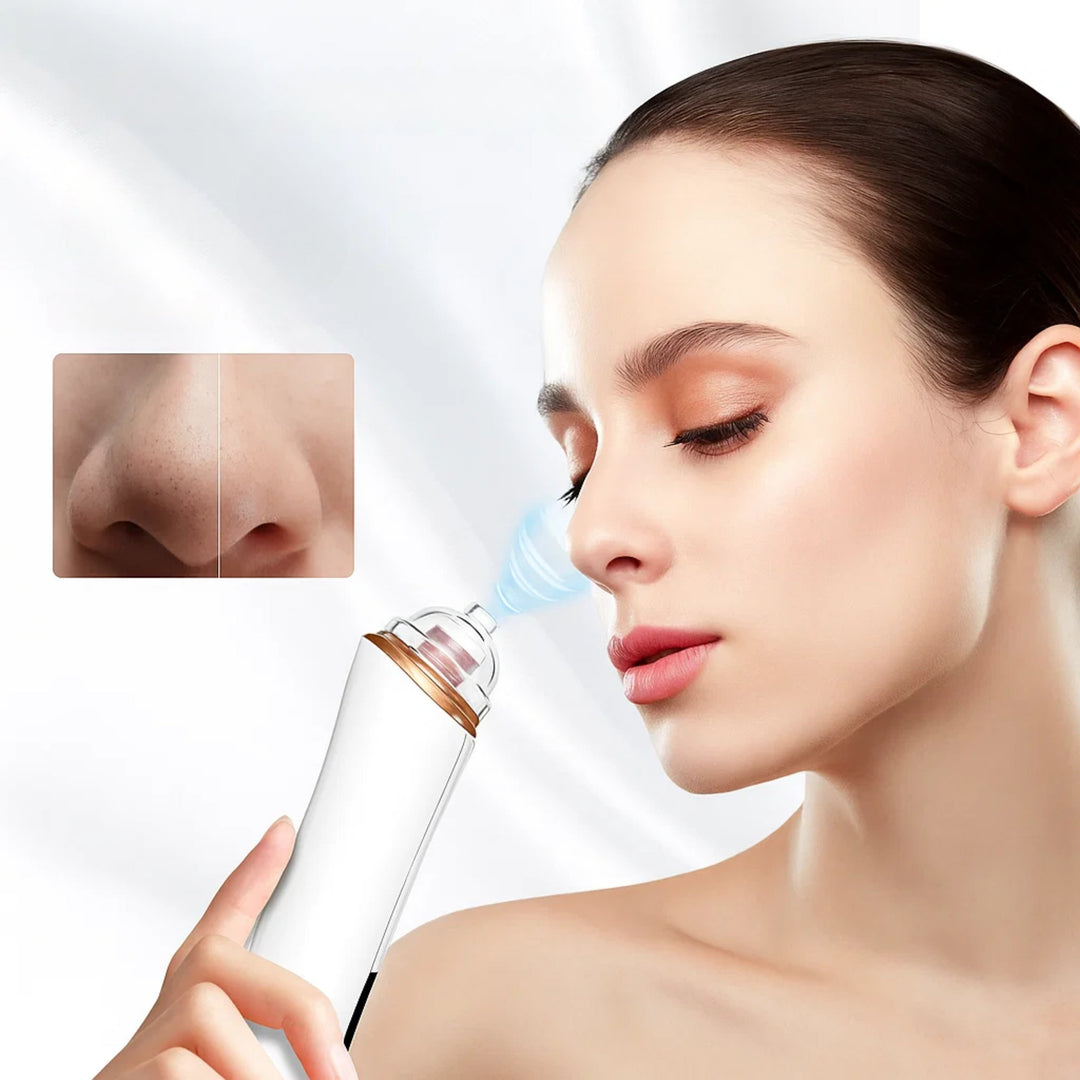GlowEase | Microdermabrasion Kit – Blackhead Remover – USB Rechargeable – At-Home Skincare Solution Bowlift