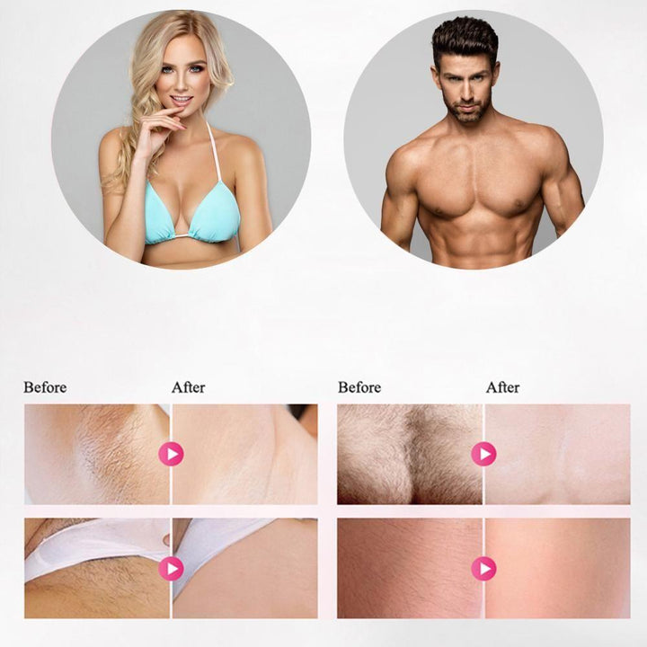 BowLift | Professional IPL Epilator Laser Hair Removal