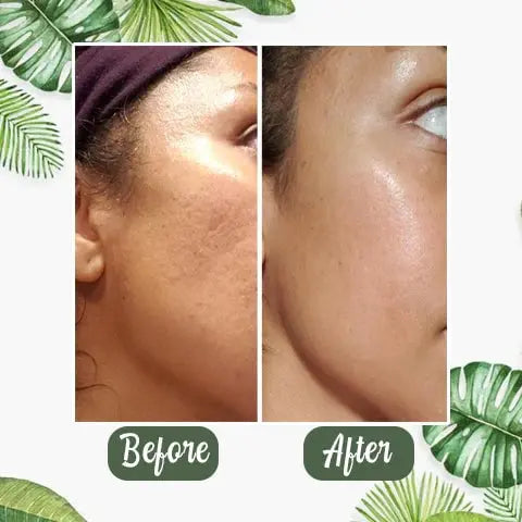 BowLift | Green Tea Deep Cleansing Mask – Against Sebum, Dirt & Clogged Pores