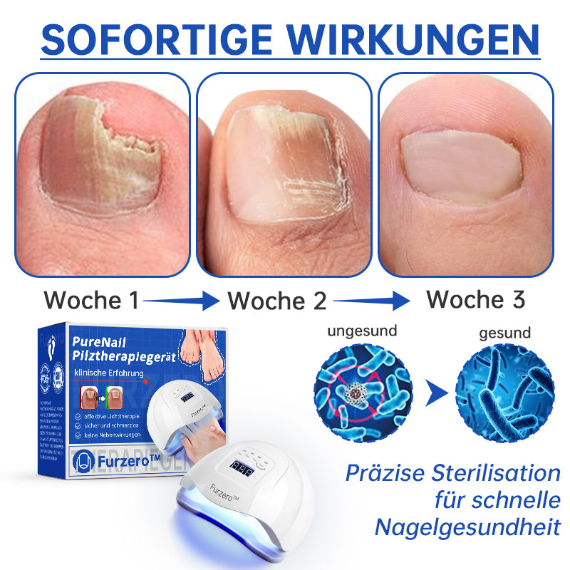 BowLift | PureNail™ | Nail Fungus Laser Therapy Device - Your Secret Weapon Against Nail Fungus
