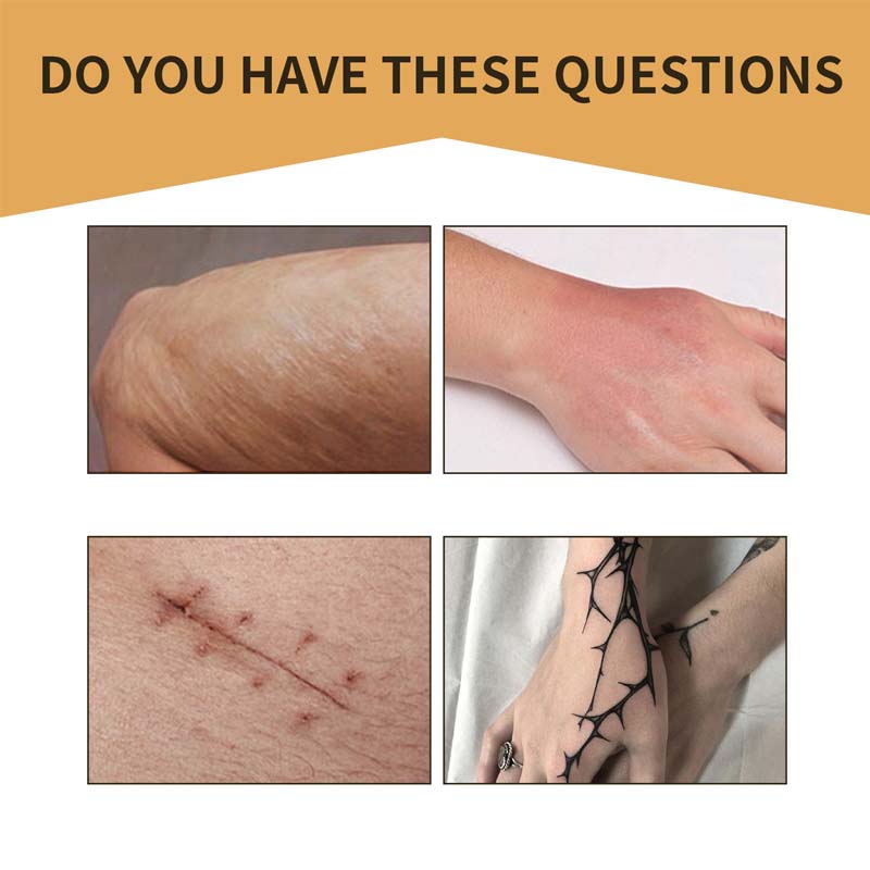 BowLift | Skin Invisible Concealer Patch