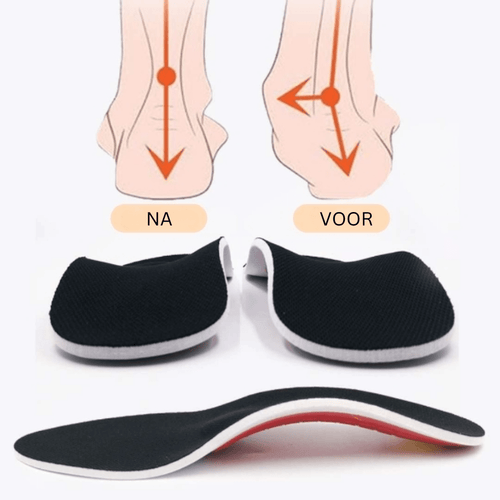 BowLift | ArchEase | Ultimate comfort for your feet