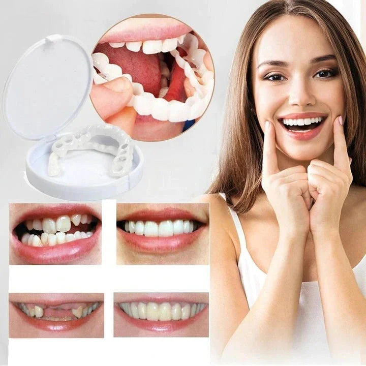 BowLift | Instant Smile Transformation with Snap on Smile Veneers