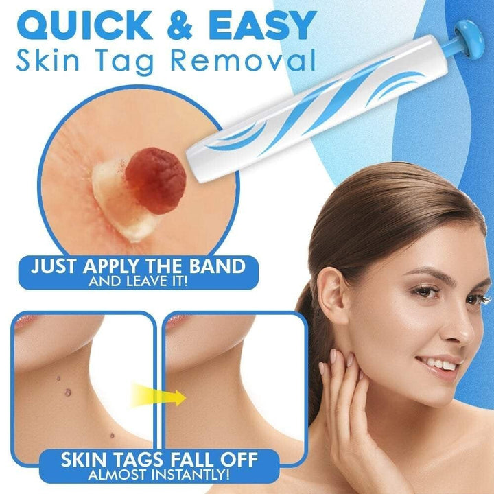 BowLift | SmoothZap — Pain-free skin freedom for a new sense of confidence in just 10 days