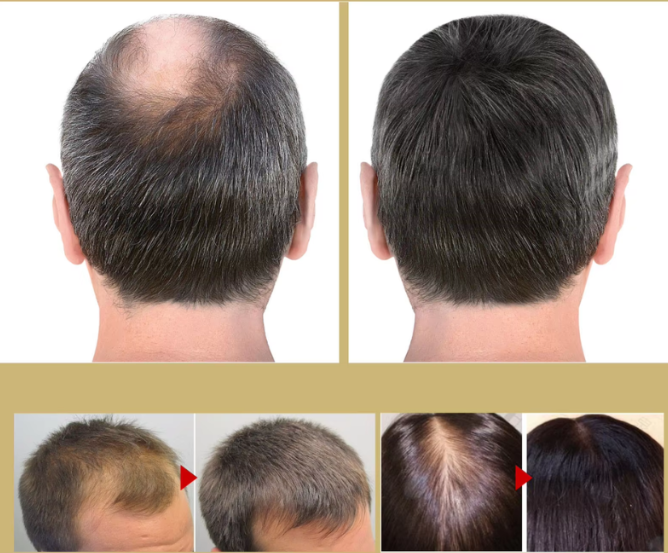 BowLift | VitaStrand – Experience thicker, stronger, and healthier hair every morning
