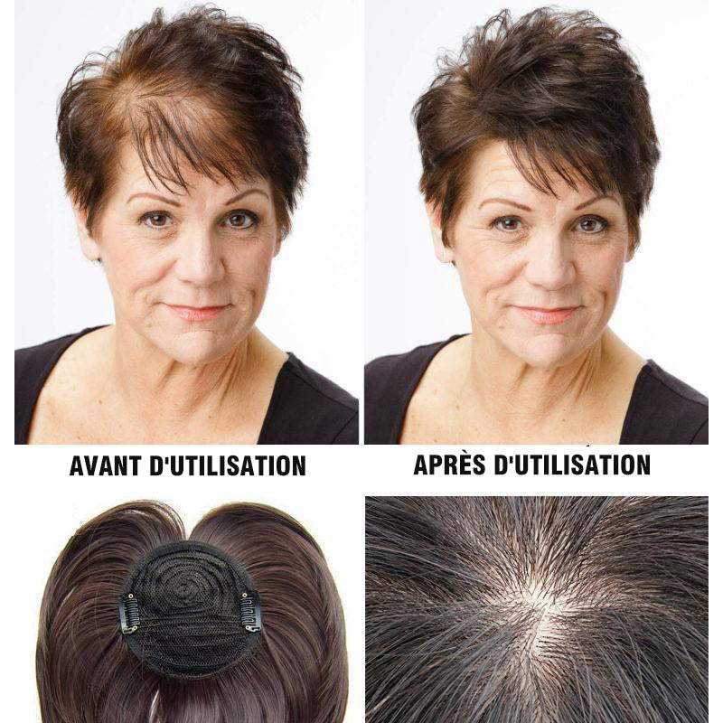 Replacement patch for wig | Bowlift