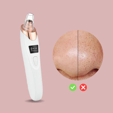BowLift | Nano Electrical Vacuum Blackhead Remover — Unleash your radiant clear skin without pain or stress