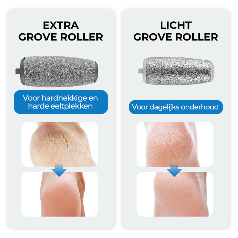 BowLift | SmoothFoot – Achieve silky smooth feet in just a few minutes