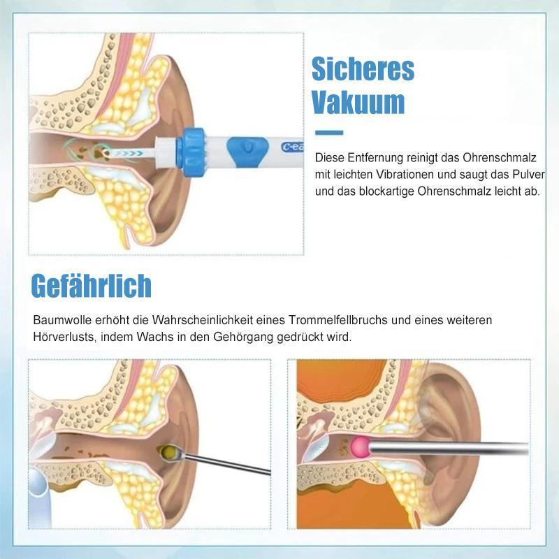 BowLift | Earwax remover vacuum