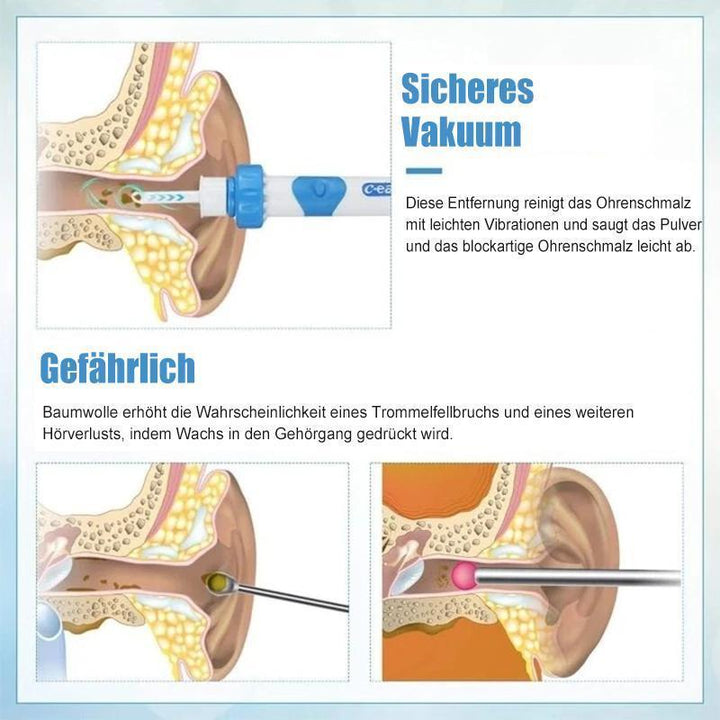 BowLift | Earwax remover vacuum