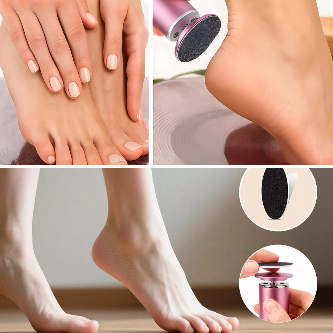 Hard Skin Removal – Waterproof Rechargeable – Restores Soft Smooth Feet Instantly Bowlift
