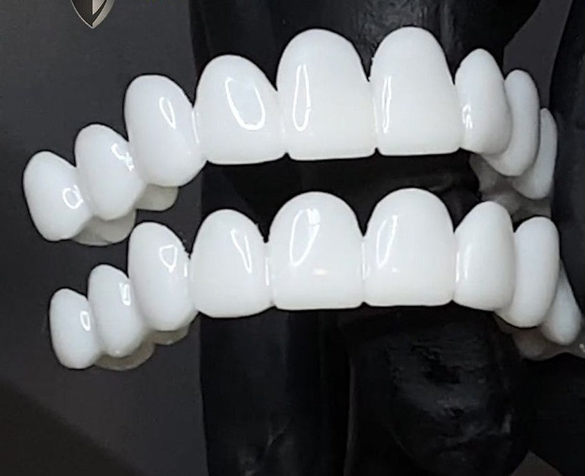 Smile Lens – Adjustable White Denture for Instant Smile Correction | Bowlift
