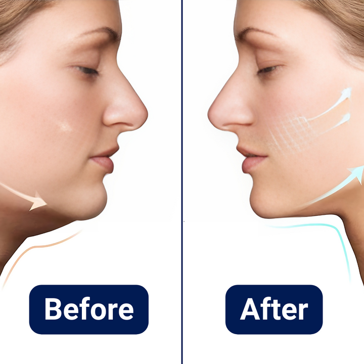 Facial Tightening Massager for Double Chin Reduction Bowlift