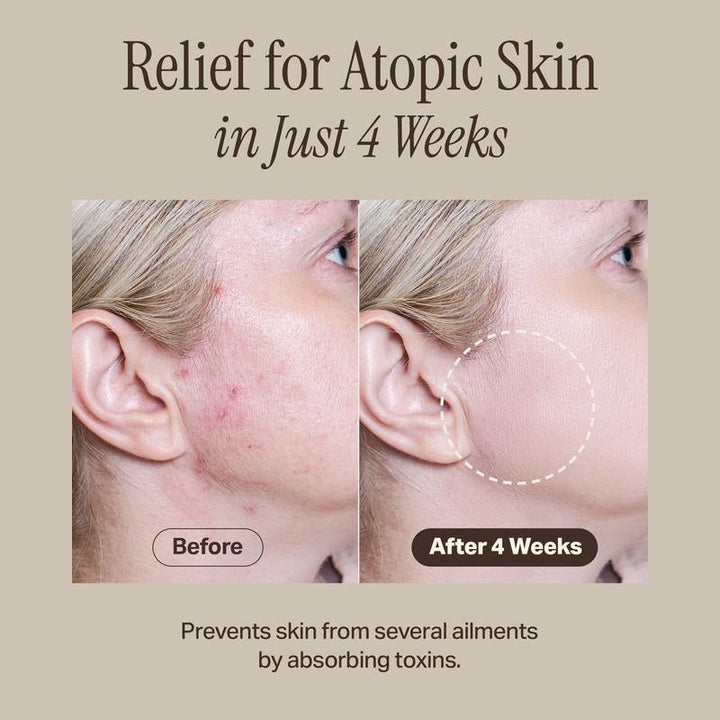 BowLift | Relief Mud Mask