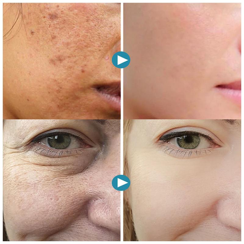 BowLift | SilkPores | Smooth and radiant skin