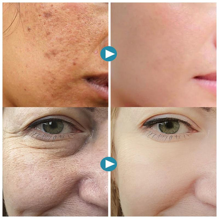 BowLift | SilkPores | Smooth and radiant skin