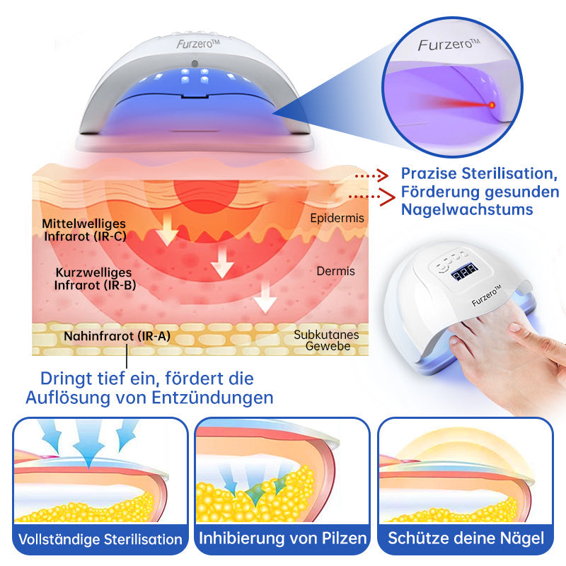 BowLift | PureNail™ | Nail Fungus Laser Therapy Device - Your Secret Weapon Against Nail Fungus