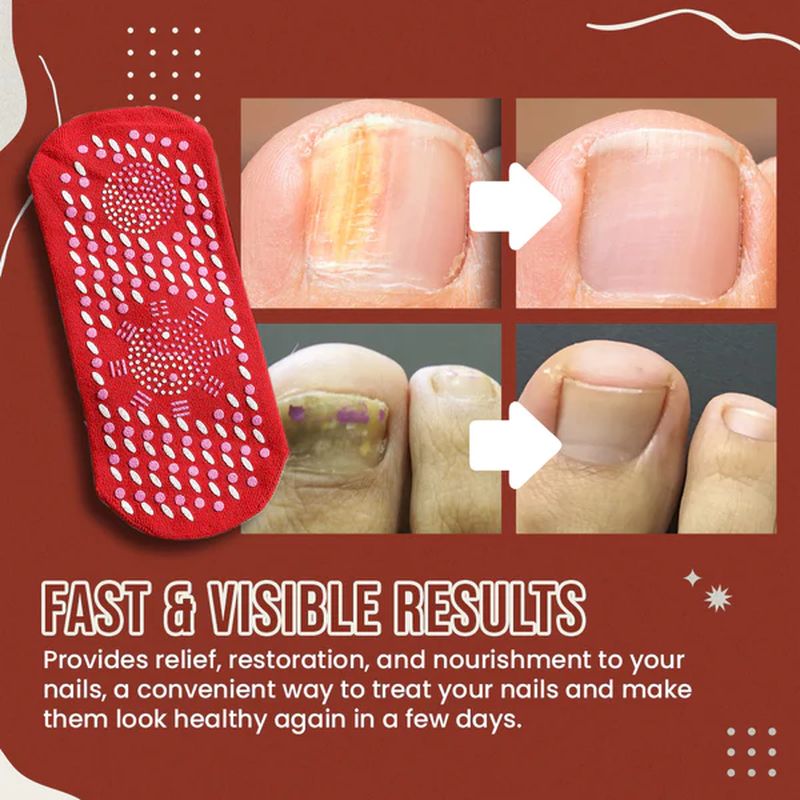 BowLift | Nail Anti-Fungus Socks
