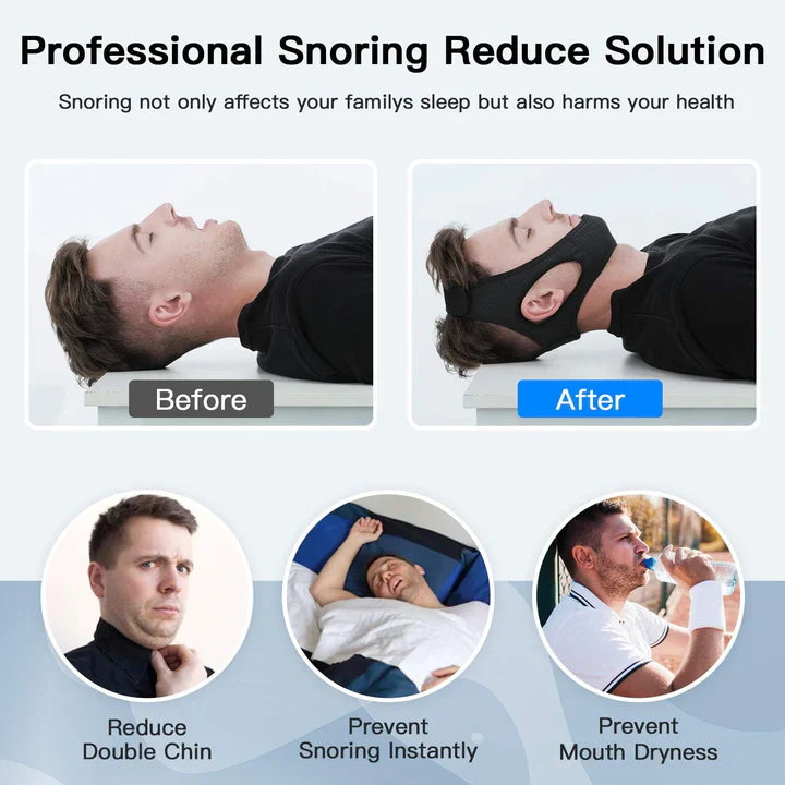 BowLift | Anti-Snore Chin Strap