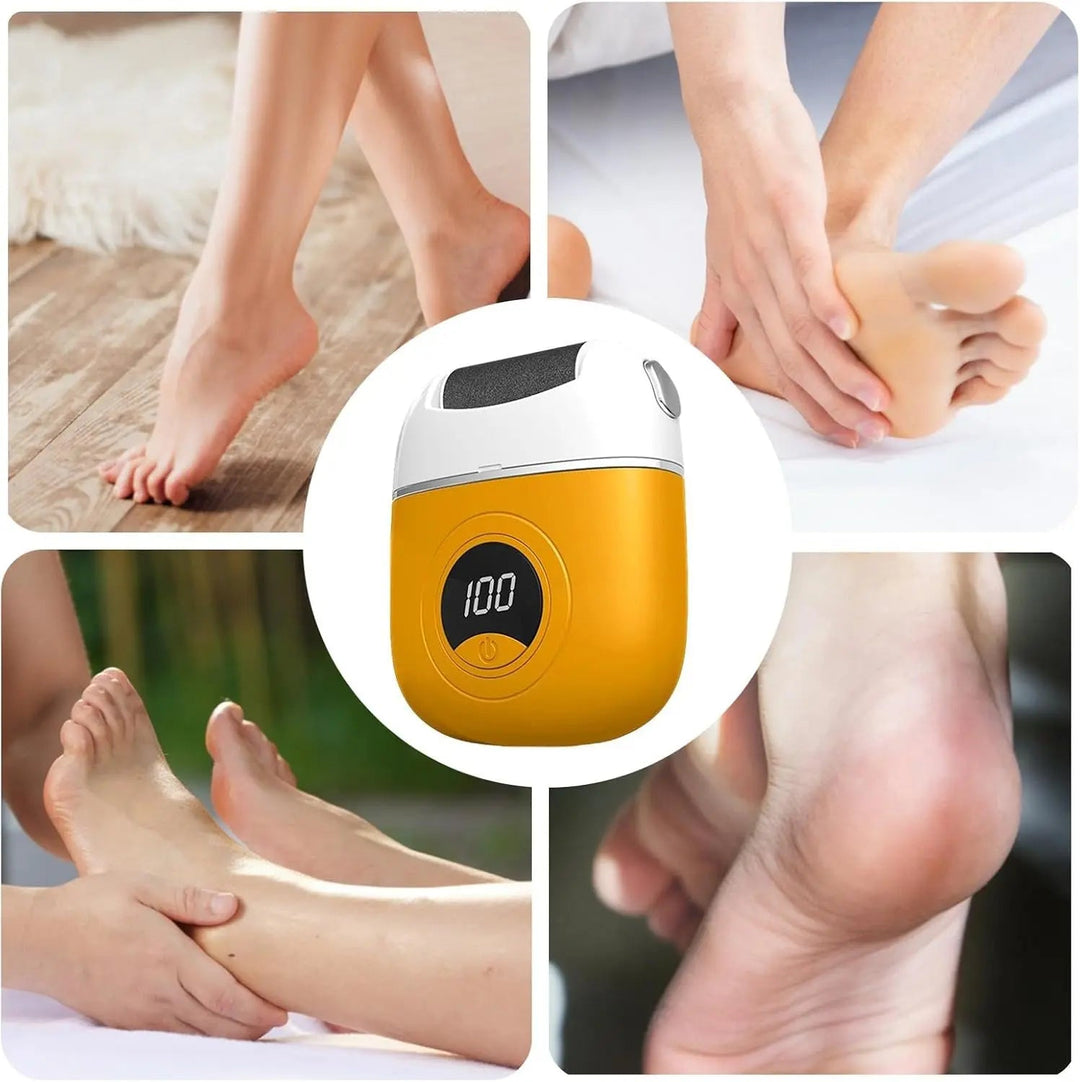 BowLift | Mivoza Electric Callus Remover — Free your feet and enjoy silky smooth lightness with every step!