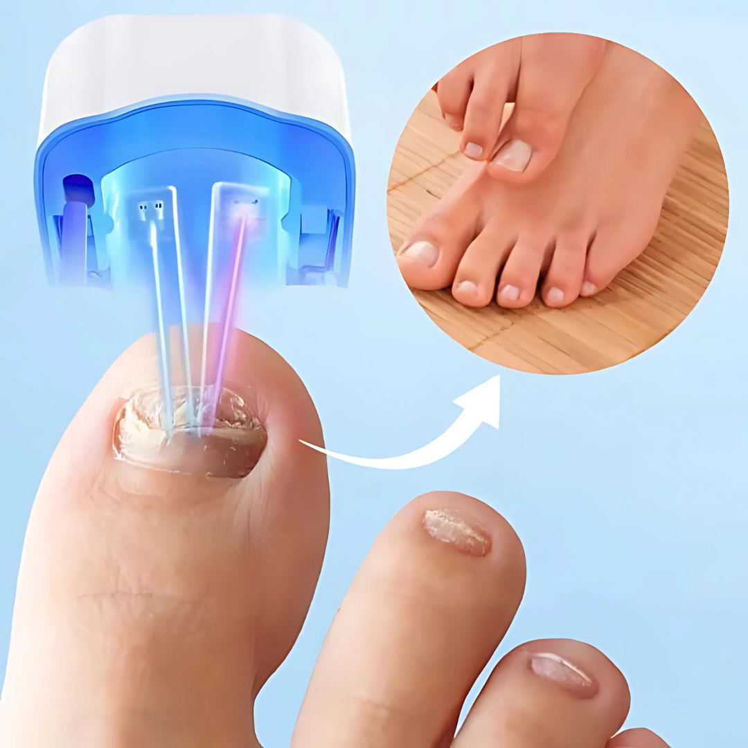 BowLift | Nail Treatment Laser Device for Fungal Care
