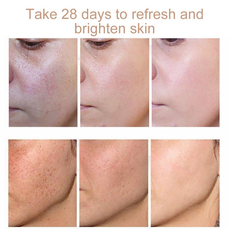 BowLift | Face Freckles Removal Cream