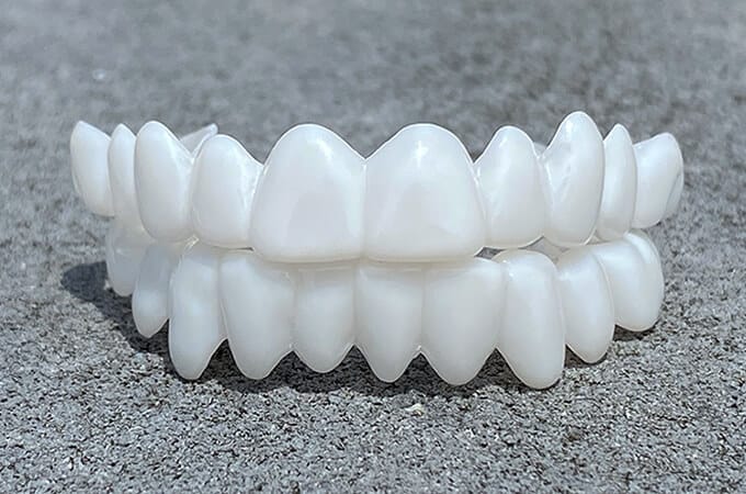 Cosmetic Tooth Toppers SmileShape – Reusable, Flexible and Naturally White | Bowlift