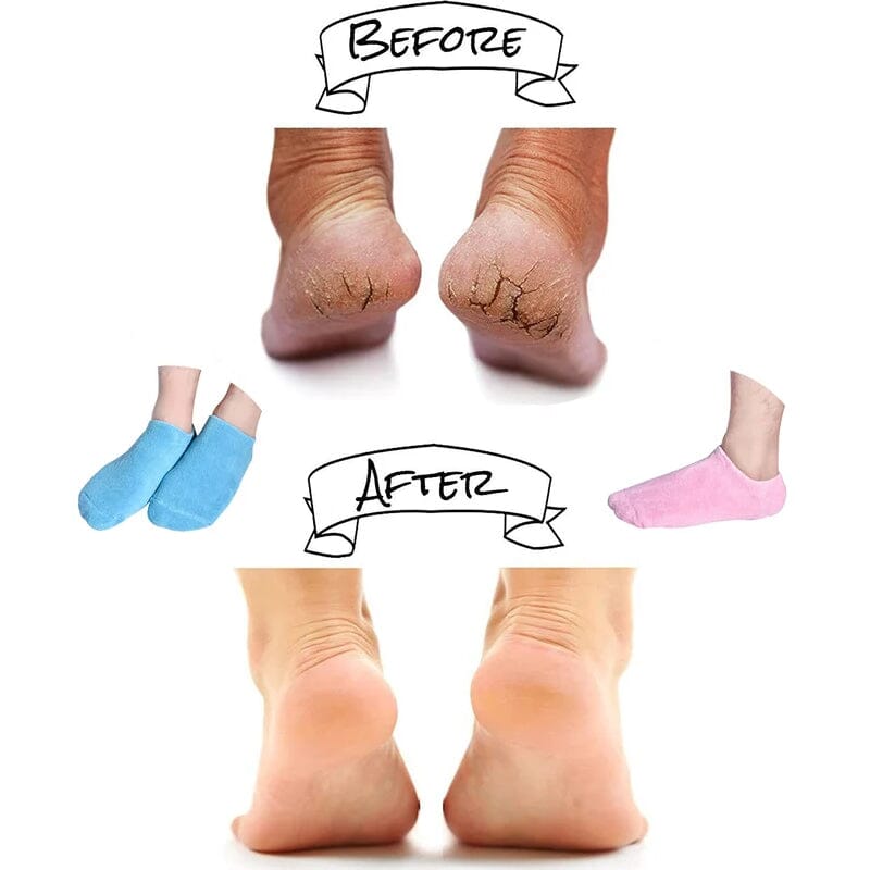 Moisturizing socks with gel lining Bowlift