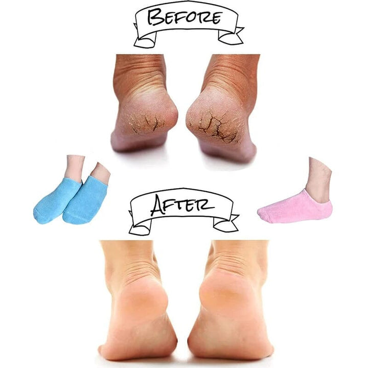 Moisturizing socks with gel lining Bowlift