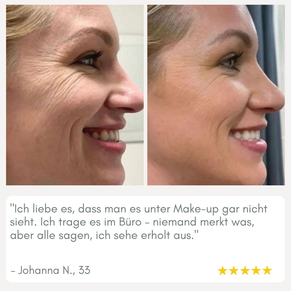 BowLift | YouthMorph — Tight skin in minutes for your youthful WOW moment