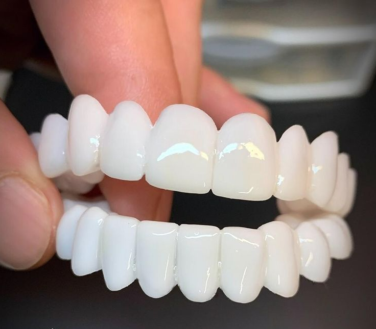 Cosmetic Tooth Toppers SmileShape – Reusable, Flexible and Naturally White | Bowlift