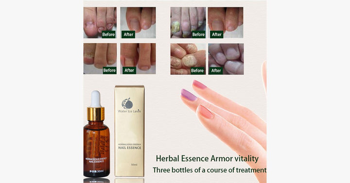 BowLift | Wonder Nail Essence – The best solution for healthy nails