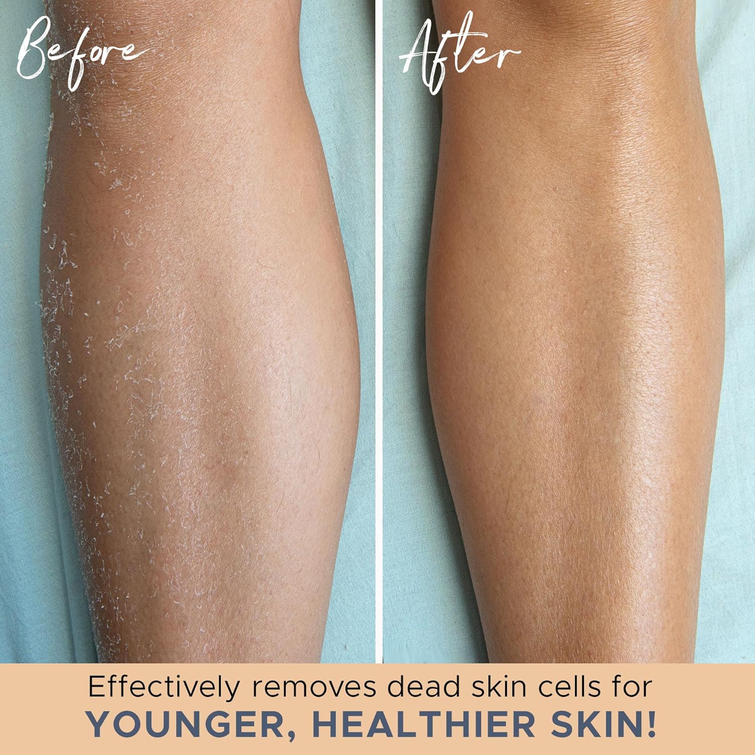 BowLift | Exfoliating Bath Gloves – Set of 2