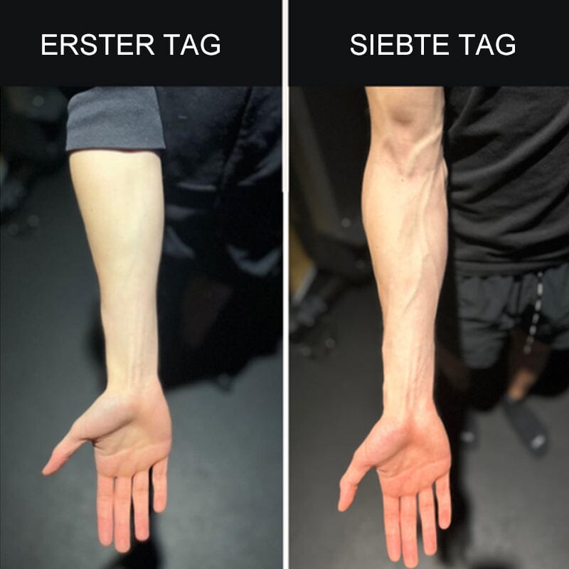 BowLift | Silicone Finger Exercise Trainer