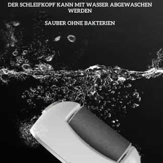 BowLift | Mivoza Electric Callus Remover — Free your feet and enjoy silky smooth lightness with every step!