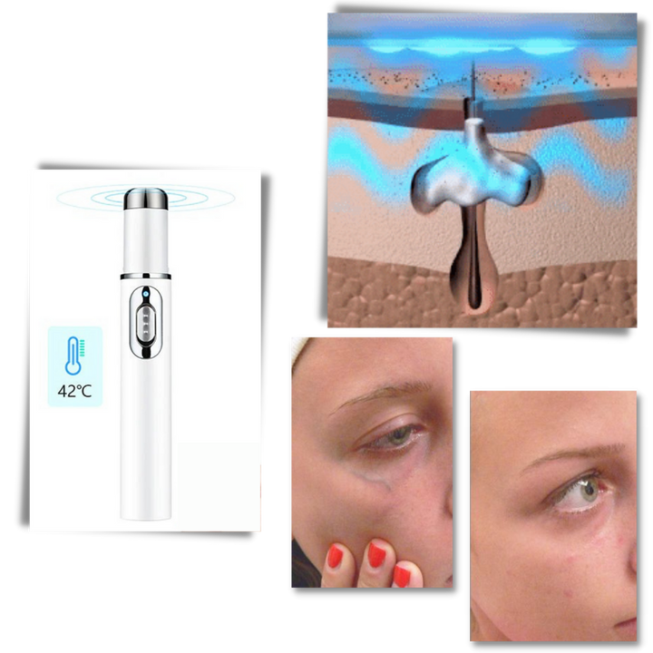 BowLift | Blue light skin therapy pen