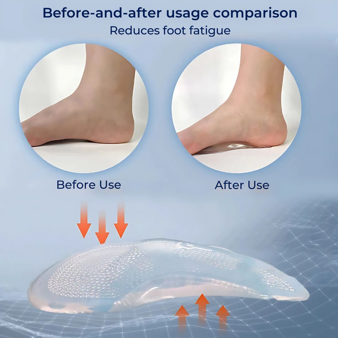 ComfortStep Gel Arch Support Insoles | Relieve Foot Pain - Reduce Fatigue - Improve Posture - Shock Absorbing Insoles Bowlift
