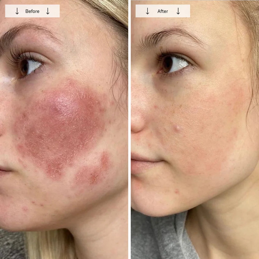 Red Light Therapy Face Mask for Wrinkles & Skin Rejuvenation