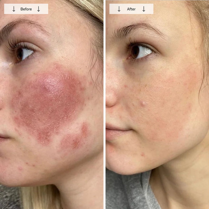 Red Light Therapy Face Mask for Wrinkles & Skin Rejuvenation