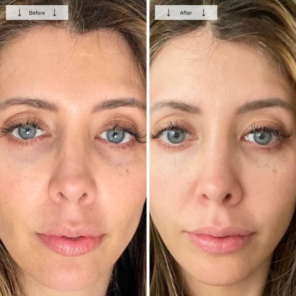 Red Light Therapy Face Mask for Wrinkles & Skin Rejuvenation
